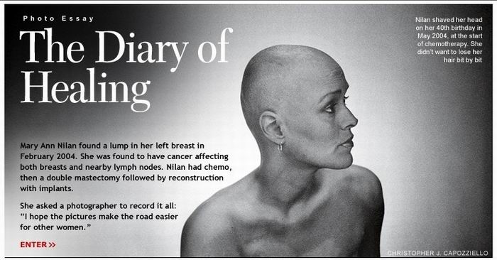 เธอผู้ต่อสู้กับมะเร็งร้าย!!! 