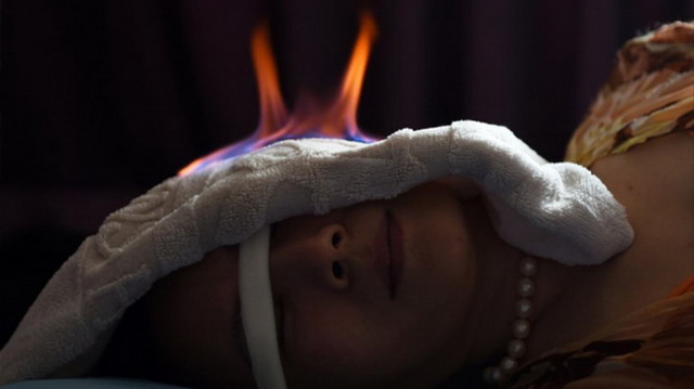 ภาพไฟบำบัดในจีน จุดไฟบนตัวคนไข้รักษาสารพัดโรค