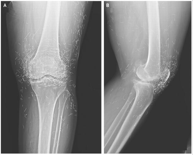 ภาพ X-Rays วัตถุประหลาดในร่างกายมนุษย์