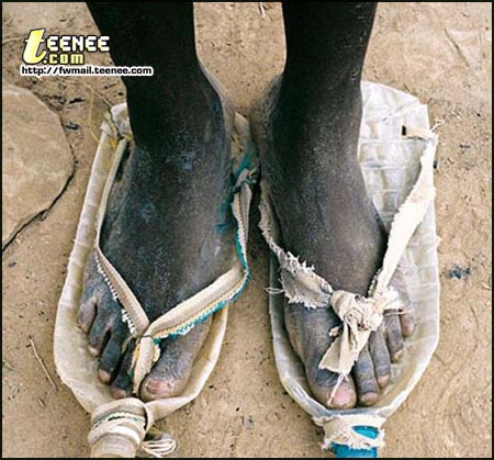เห็นภาพนี้แล้ว คุณจะเข้าใจว่า ประโยชน์ของรองเท้าที่แท้จริงคืออะไร
