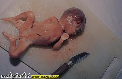 เมนูพิสดาลกินเด็กทารกที่จีน