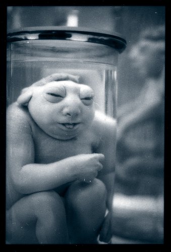 ~~~ภาพทารกในขวดแก้ว ~~~(2)  