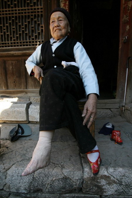 สมัยนึงที่จีนเค้านิยมกัน ดัดกันต้องแต่เด็กสมัยนั้นเท้าแบบนี้แหละที่เค้าว่าสวย! ส่วนจะสวยตรงไหนยังไงก็ลองพิจารณาดูกันนะ!