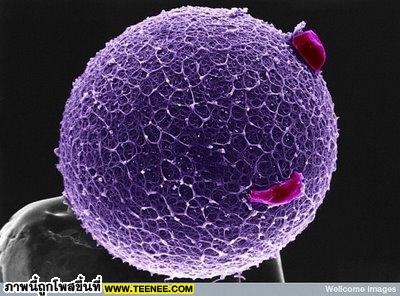 11. Human Egg With Coronal Cellsภาพนี้เป็นภาพของไข่ก่อนจะถูกผสมพันธ์ ไข่จะถูกปกคลุมไว้ด้วย zona pellicuda ซึ่งทำหน้าปกป้องและดัก sperm