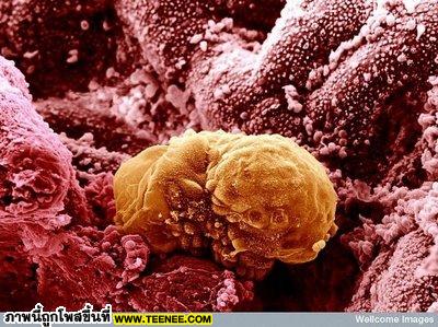 14. Six Day Old Human Implanting ภาพนี้เป็นภาพตัวอ่อนอายุ 6 วัน ในมดลูกของเพศหญิง