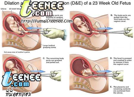 ก่อนจาทำคิดดุนะ ว่า ท่าเราเป็นเด้กที่โดน จา เจ็บมะ