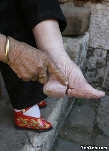 คนจีนสมัยก่อนใส่รองเท้าแบบนี้