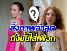 ภาพล่าสุด คลาวเดีย จักรพันธุ์ หลังวูบหัวฟาด ต้องใส่เฝือกจมูก