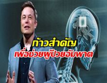 ประวัติศาสตร์! Neuralink ของอีลอนมัสก์ ฝังชิปสมองให้ผู้ป่วยสำเร็จ