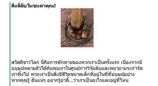 อะไรอยู่ที่ขนตา..ของคุณ