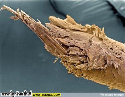 2. Split End Of Human Hair เป็นภาพเส้นผมของเราที่แตกหักตรงส่วนปลาย วิธีแก้ก็อย่างที่พวกเราทราบกันดี คือหมันเล็มปลายผมและใช้ครีมนวดบำรุงเส้นผม